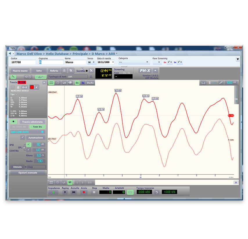ABR repeatability