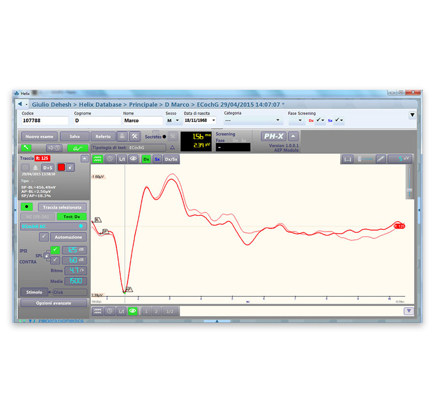 non invasive ECochG